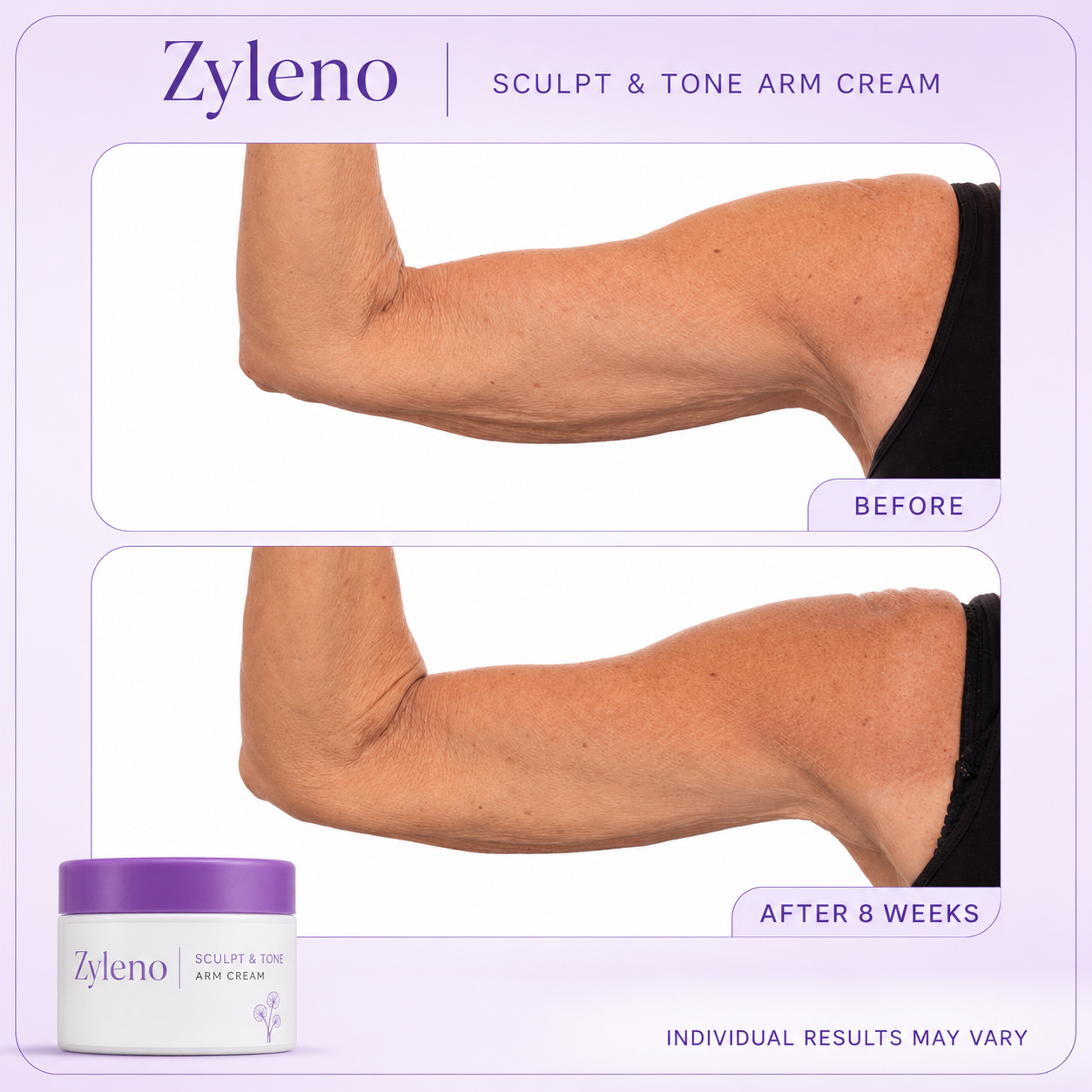 Zyleno Sculpt & Tone Arm Cream